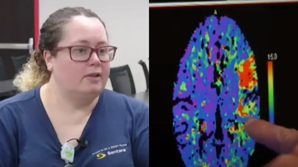 Nurse Didn't Know She Was Having A Stroke While Working—Saved by Her Quick-Thinking Team