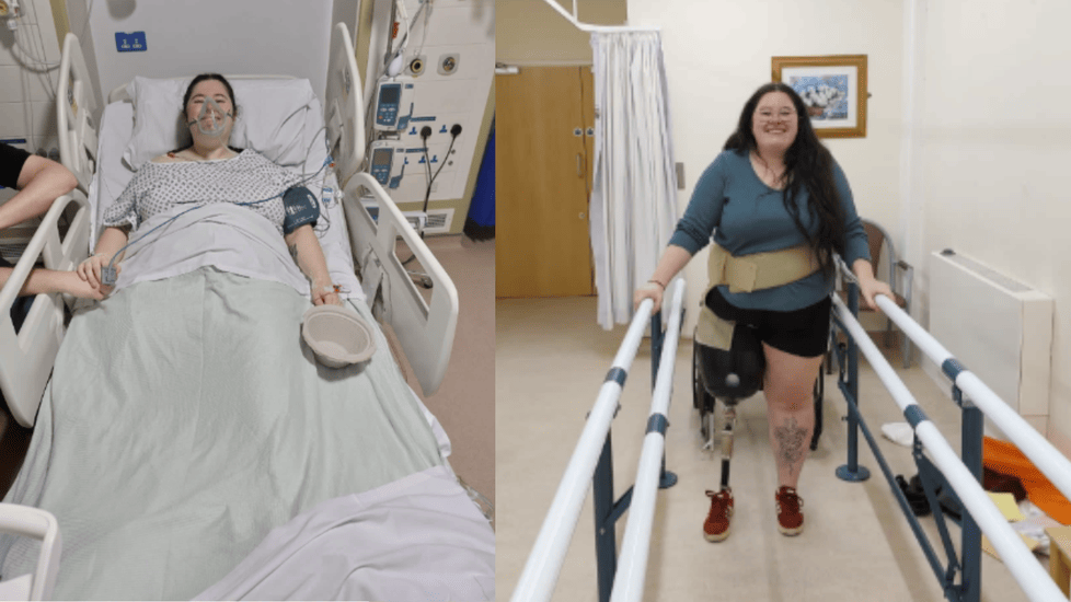 Nurse Thought It Was a Muscle Strain—Turns Out It Was Bone Cancer