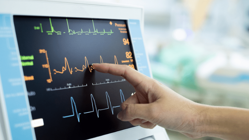 Top EKG Technician Certification Programs