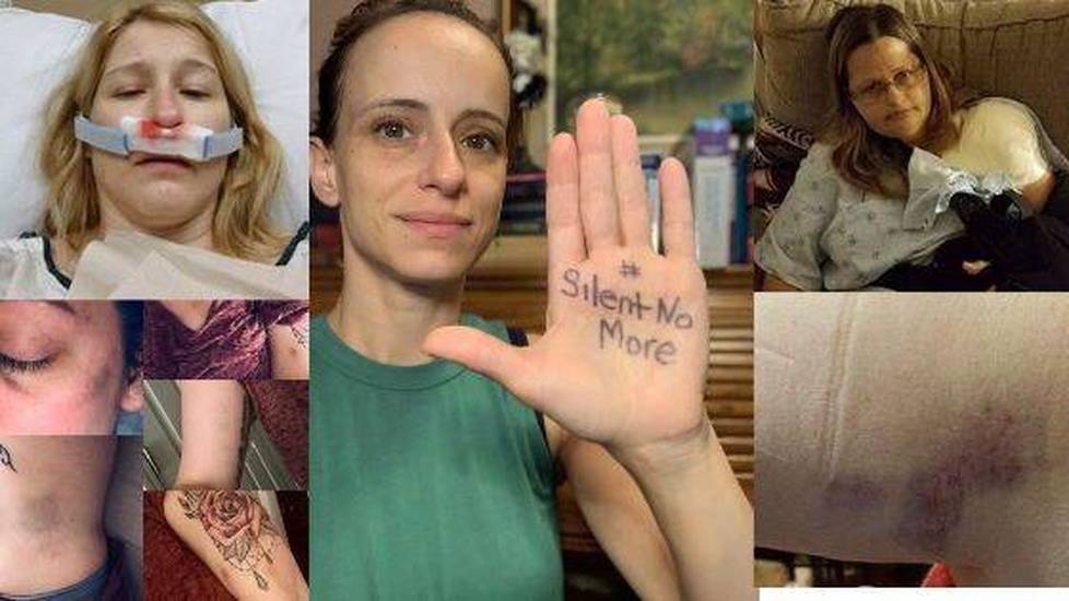 Multiple nurses demonstrating results of workplace violence