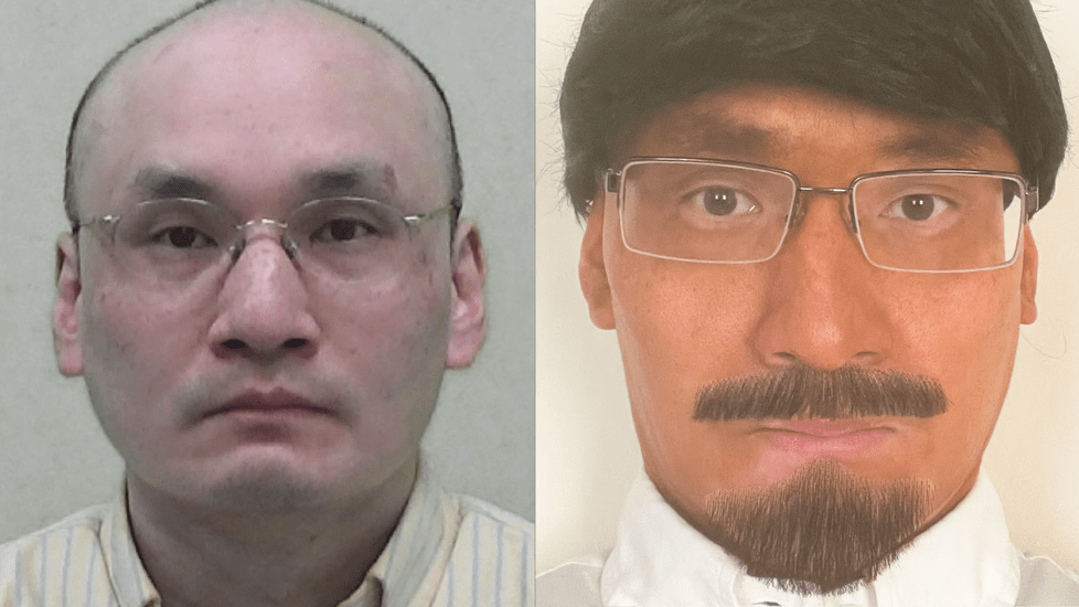 Doctor Faked Being A Nurse To Inject Mom's Partner With Flesh Eating Toxin