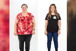 Before-and-after image of a registered nurse at Emplify Health by Gundersen, showing visible weight loss following bariatric surgery.