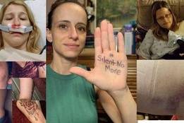 Multiple nurses demonstrating results of workplace violence