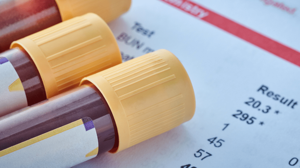 NCLEX lab values nurses must know