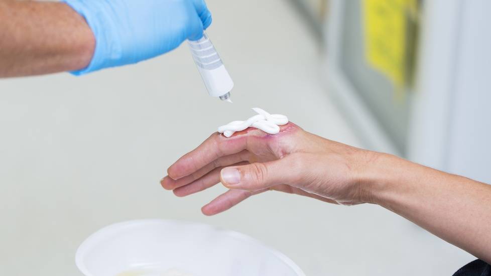 New Burn Nursing Specialty Certification Expected by 2023