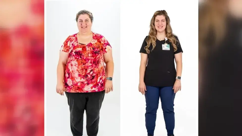 Before-and-after image of a registered nurse at Emplify Health by Gundersen, showing visible weight loss following bariatric surgery.