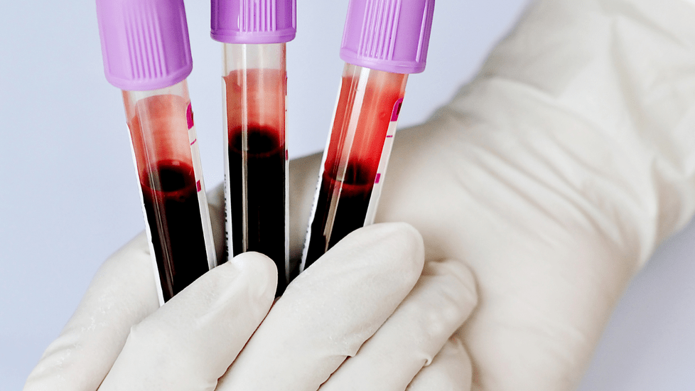 Blood Donations Reach 10 Year Low Amid Extreme Shortages